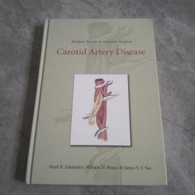 Carotid Artery Disease