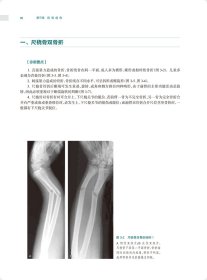 骨关节创伤X线诊断图谱（第4版） 9787117328548