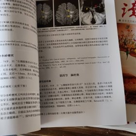 脑血管病诊断与鉴别诊断：临床实例图示