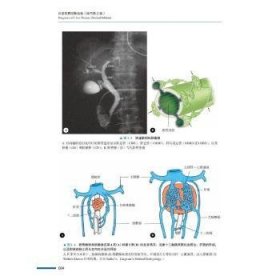 肝脏疾病诊断精要