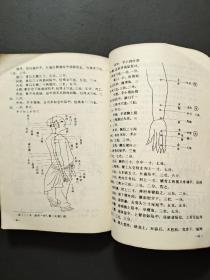 针灸易学（中医古籍整理丛书）【大32开 90年一印 仅印6000册 看图见描述】