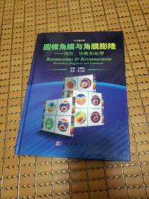 圆锥角膜与角膜膨隆：预防、诊断和处理