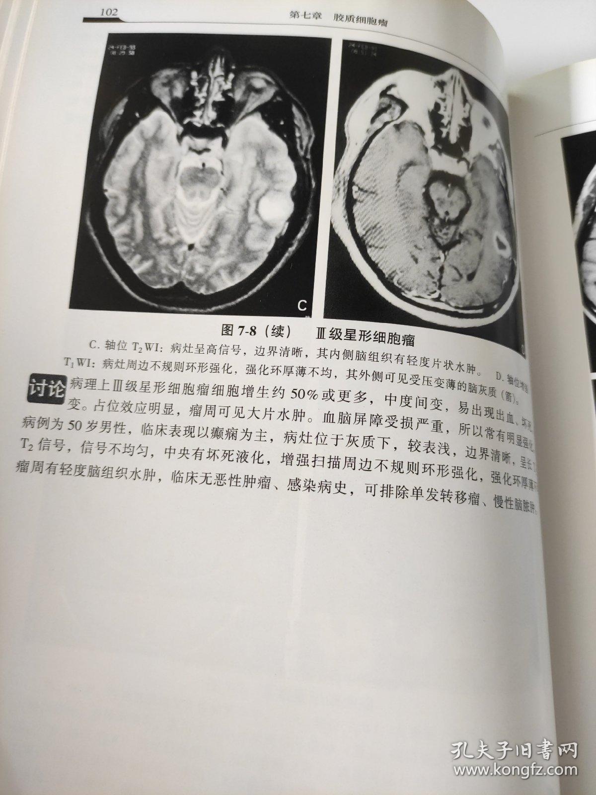 神经疾病影像学图鉴——临床影像学图鉴系列