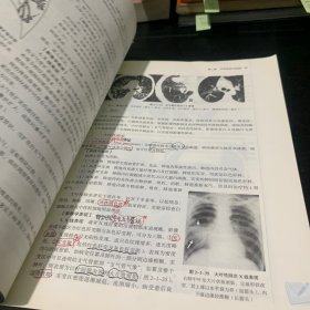 医学影像学·全国中医药行业高等教育“十四五”规划教材