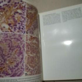 COMPREHENSIVE CANCER CYTOPATHOLOGY OF THE CERVIX UTERI（子宫颈癌的综合癌症细胞病理）