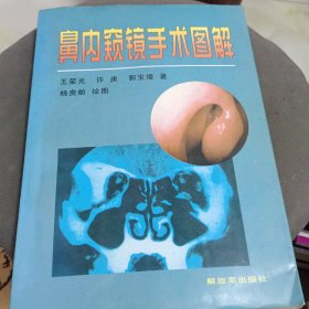 鼻内窥镜手术图解[签名本]