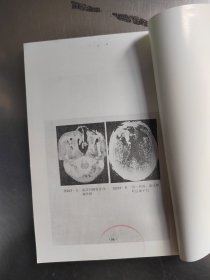 头颈部cT临床实用图谱（无笔记丶品相好丶实物拍摄）