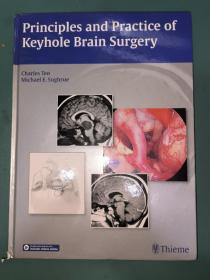 Principles and Practice of Keyhole Brain Surgery   锁孔脑外科的原理与实践