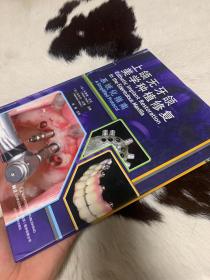 上颌无牙颌美学种植修复系统化指南