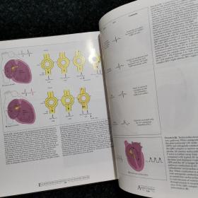 ESSENTIAL ATLAS OF HEART DISEASES