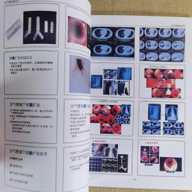 中华医学会结核病学分会呼吸内镜介入专业委员会2018年学术年会会议资料