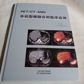 PET/CT--MRI异机图像融合的临床应用PDA1020---精装大16开9品，2023年1版1印