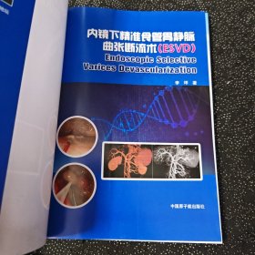 内镜下精准食管胃静脉曲张断流术ESVD