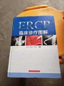 ERCP临床诊疗图解