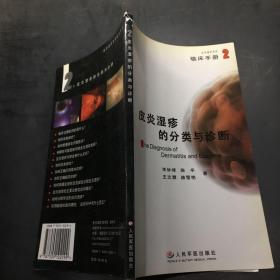 皮炎湿疹的分类与诊断