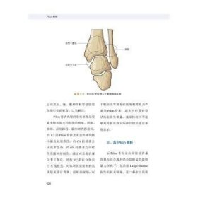 Pilon骨折李钊伟，李泽清9787523600986中国科学技术出版社