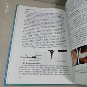 实用消化内镜治疗学