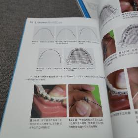 口腔正畸治疗常用弓丝弯制技术