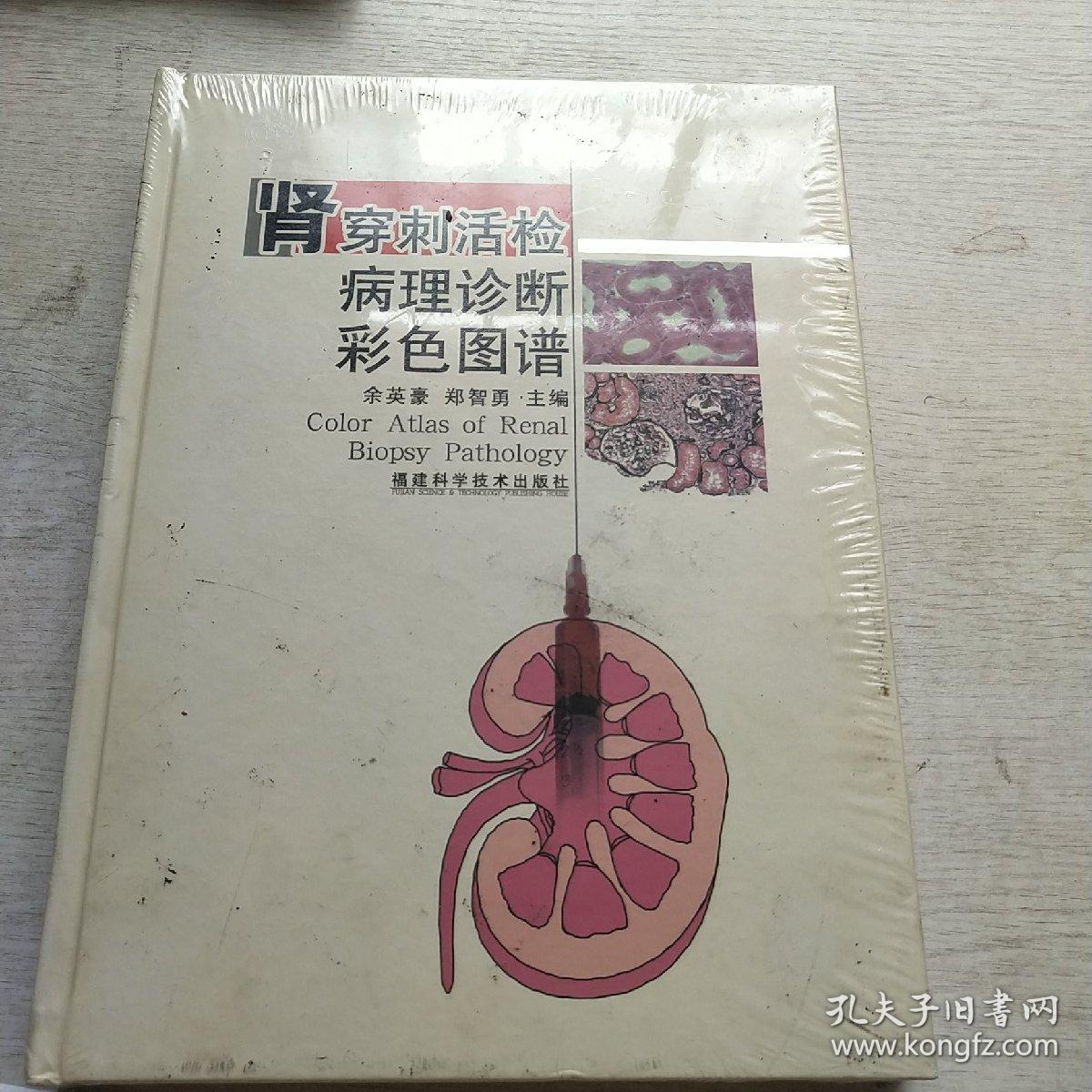 肾穿刺活检病理诊断彩色图谱