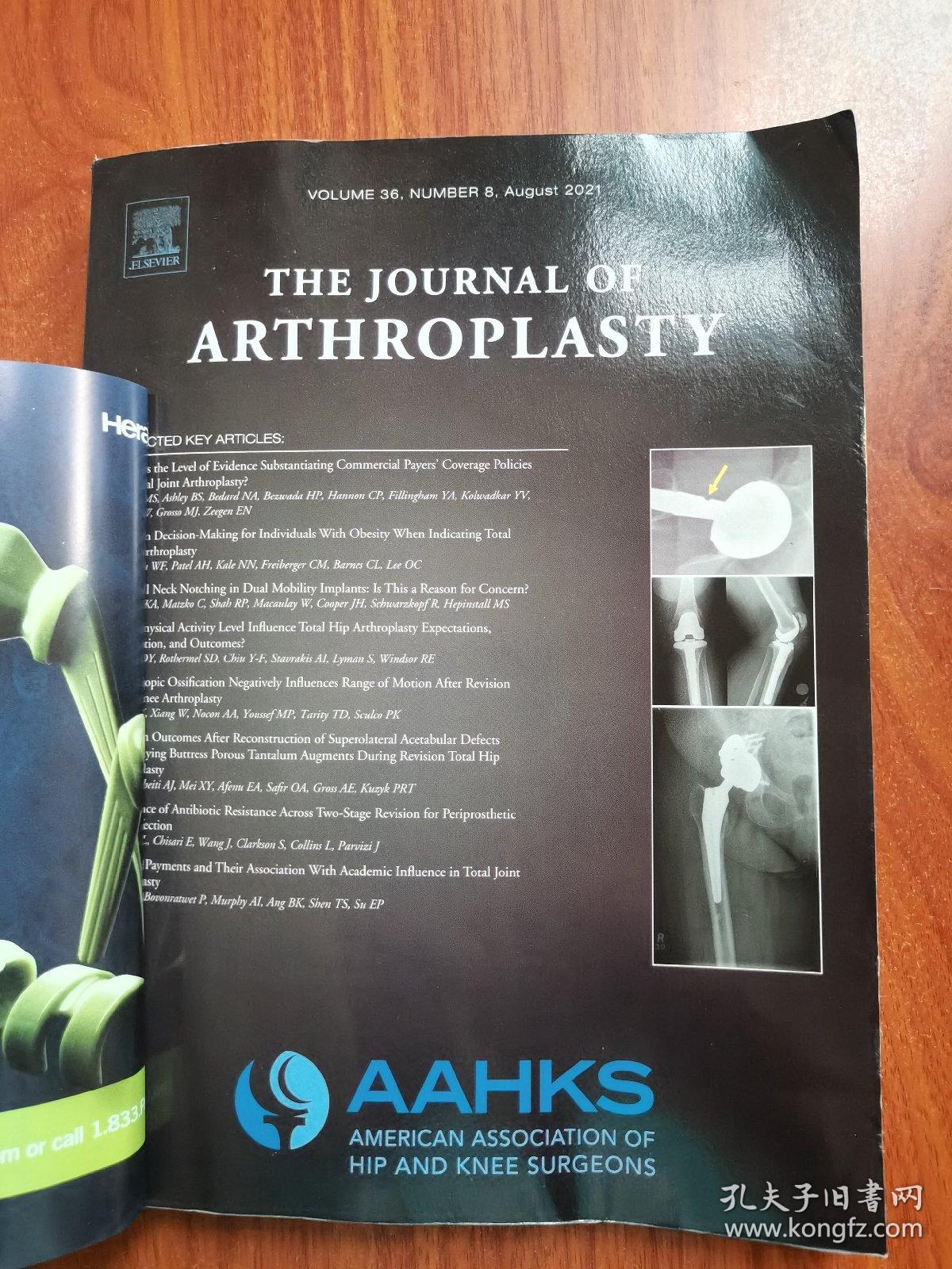 the journal of arthroplasty