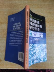 浆膜腔积液和脑脊液细胞病理学图谱