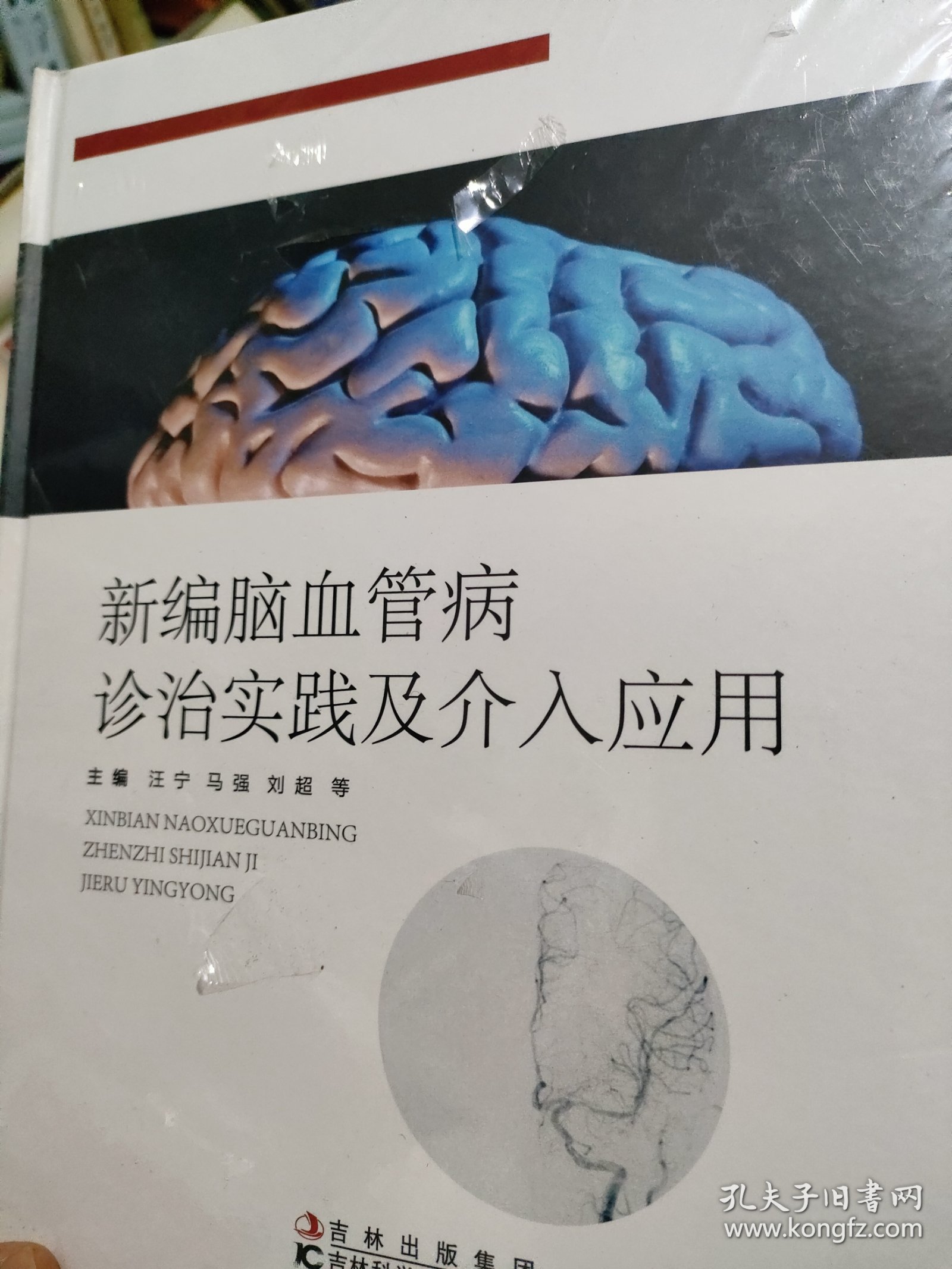 新编脑血管病诊治实践及介入应用（精装 塑封 全新）