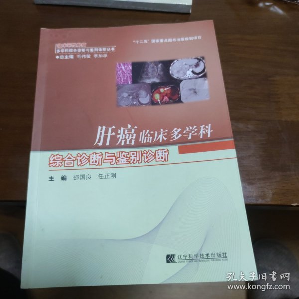 肝癌临床多学科综合诊断与鉴别诊断