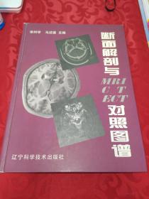 断面解剖与MRI CT ECT对照图谱