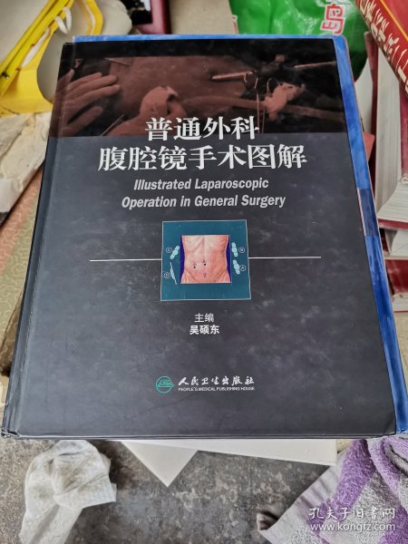 普通外科腹腔镜手术图解