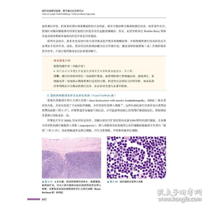 新华正版 淋巴结病理学图谱：基于模式的诊断方法 [美] Amy S. Duffield 9787504696441 中国科学技术出版社