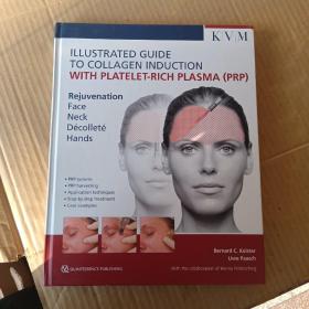 ILLUSTRATED GUIDE TO COLLAGEN INDUCTION WITH PLATELET-RICH PLASMA (PRP) 富含血小板血浆（PRP）诱导胶原的图解指南