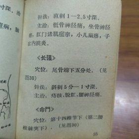 《简易针刺手册》