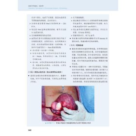 妇科手术技巧 妇科学 9787504686510