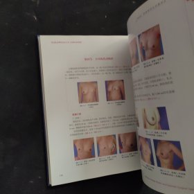 外科新技术图谱系列·常用乳房整形美容手术：实例分析图谱
