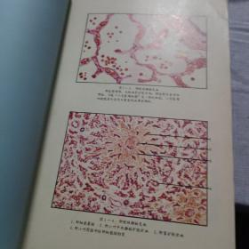 病理解剖学图谱（全书收录插图520幅) 1979年一版一印