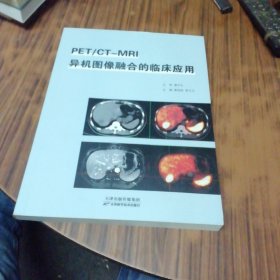 PET/CT/-MRI 异机图像融合的临床应用