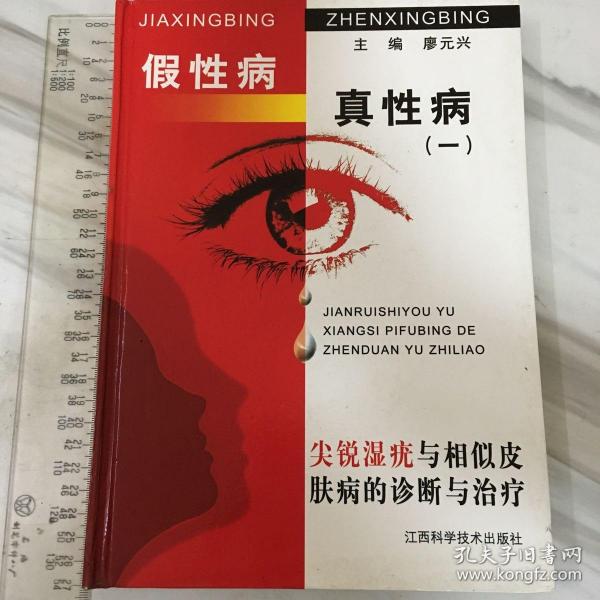 假性病真性病（1）：尖锐湿疣与相似皮肤病的诊断与治疗