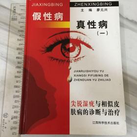 假性病真性病（1）：尖锐湿疣与相似皮肤病的诊断与治疗