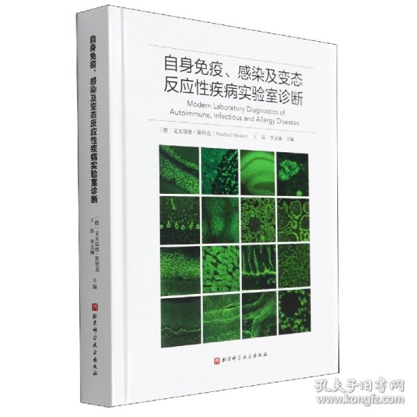 自身免疫、感染及变态反应性疾病实验室诊断