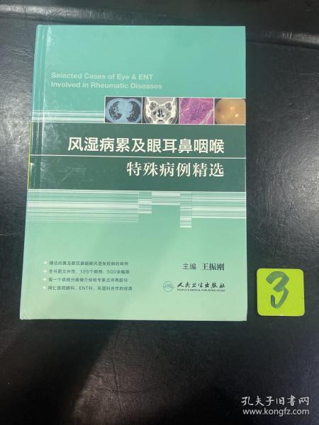 风湿病累及眼耳鼻咽喉特殊病例精选