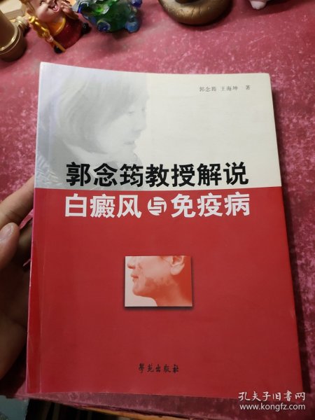 郭念筠教授解说白癜风与免疫病