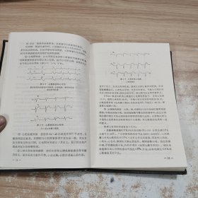 心脏急症