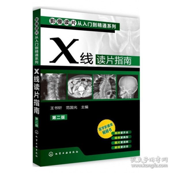 影像读片从入门到精通系列：X线读片指南（第2版）