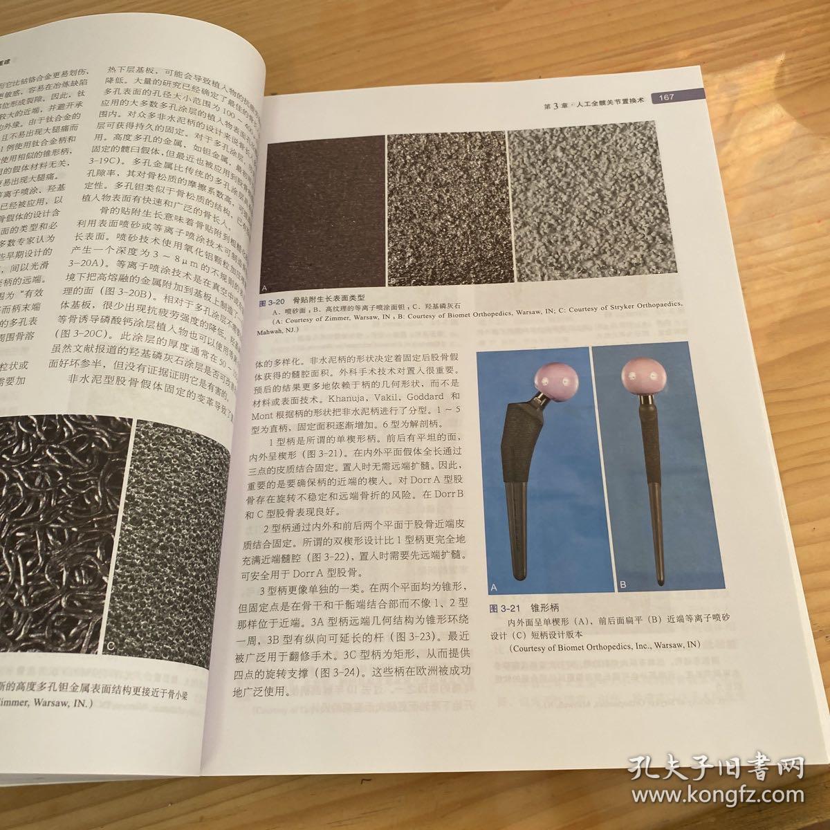 关节外科（普及版）/坎贝尔骨科手术学（第13版 第1卷）