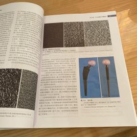 关节外科（普及版）/坎贝尔骨科手术学（第13版 第1卷）