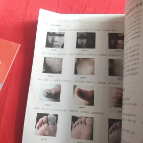 人乳头瘤病毒感染防治 派特灵、伊可尔应用技术 第八版