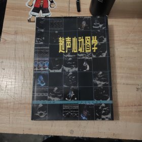 超聲心動(dòng)圖學(xué)