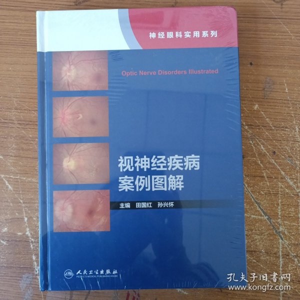 视神经疾病案例图解（神经眼科实用系列）