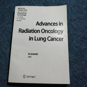 Advances in Radiation Oncology in Lung Cancer   肺癌放射肿瘤学研究进展