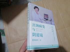 宫颈病变与阴道镜